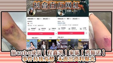 抖音百万网红 前cuba成员【程鑫凯】家暴【鸡腿诺】事件持续发酵 未流出资料曝光!